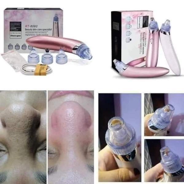 جهاز شفط الدهون